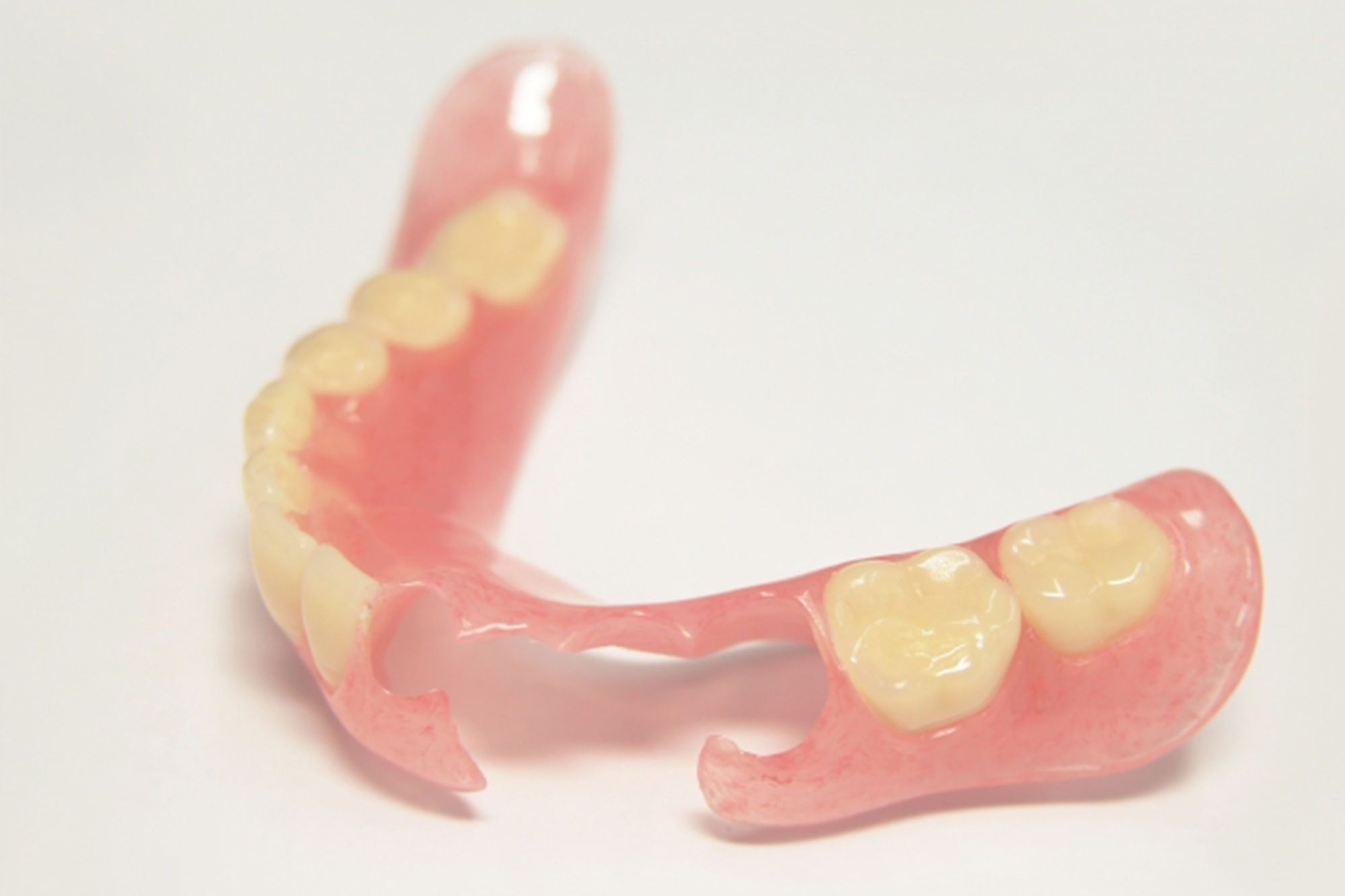 ノンクラスプデンチャーイメージ画像